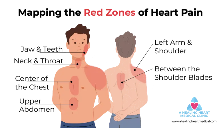 Mapping Heart Pain Radiation Red Zones