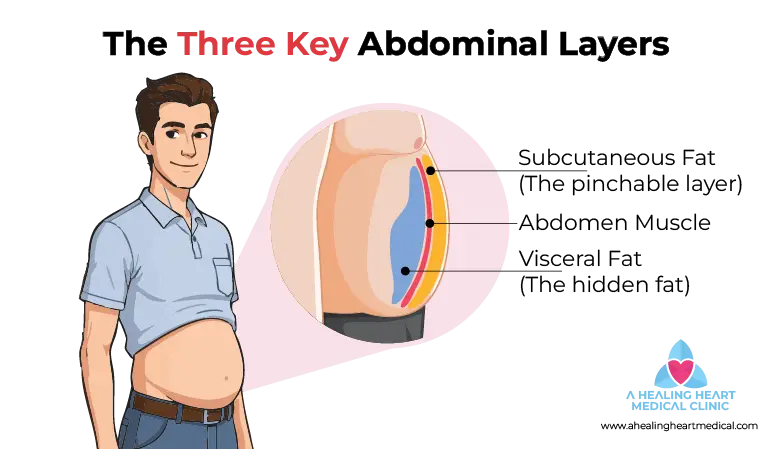 Illustration of Subcutaneous Fat, Visceral Fat, and Abdomen Muscle